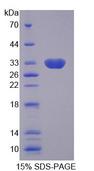 SLC25A13 / CITRIN Protein - Recombinant Solute Carrier Family 25 Member 13 (SLC25A13) by SDS-PAGE