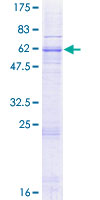 SLC25A14 / UCP5 Protein - 12.5% SDS-PAGE of human SLC25A14 stained with Coomassie Blue