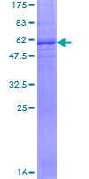 SLC25A15 / ORNT1 Protein - 12.5% SDS-PAGE of human SLC25A15 stained with Coomassie Blue