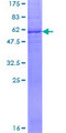 SLC25A15 / ORNT1 Protein - 12.5% SDS-PAGE of human SLC25A15 stained with Coomassie Blue