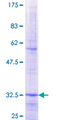 SLC25A15 / ORNT1 Protein - 12.5% SDS-PAGE Stained with Coomassie Blue.