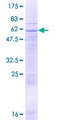 SLC25A16 / GDA / Graves Protein - 12.5% SDS-PAGE of human SLC25A16 stained with Coomassie Blue