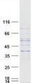 SLC25A16 / GDA / Graves Protein - Purified recombinant protein SLC25A16 was analyzed by SDS-PAGE gel and Coomassie Blue Staining