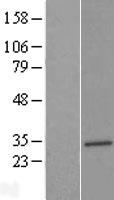 SLC25A17 Protein - Western validation with an anti-DDK antibody * L: Control HEK293 lysate R: Over-expression lysate
