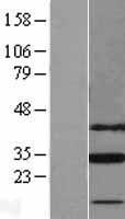 SLC25A18 Protein - Western validation with an anti-DDK antibody * L: Control HEK293 lysate R: Over-expression lysate