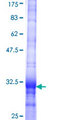 SLC25A18 Protein - 12.5% SDS-PAGE Stained with Coomassie Blue.