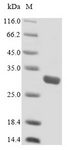 SLC25A20 / CACT Protein - (Tris-Glycine gel) Discontinuous SDS-PAGE (reduced) with 5% enrichment gel and 15% separation gel.