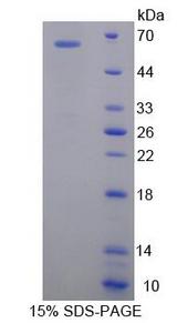 SLC25A20 / CACT Protein - Recombinant  Carnitine Acylcarnitine Translocase By SDS-PAGE