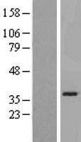 SLC25A21 / ODC1 Protein - Western validation with an anti-DDK antibody * L: Control HEK293 lysate R: Over-expression lysate