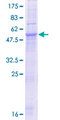 SLC25A21 / ODC1 Protein - 12.5% SDS-PAGE of human SLC25A21 stained with Coomassie Blue
