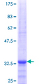 SLC25A21 / ODC1 Protein - 12.5% SDS-PAGE Stained with Coomassie Blue.
