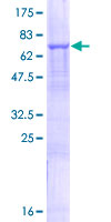 SLC25A23 Protein - 12.5% SDS-PAGE of human SLC25A23 stained with Coomassie Blue