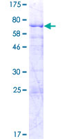 SLC25A24 / APC1 Protein - 12.5% SDS-PAGE of human SLC25A24 stained with Coomassie Blue