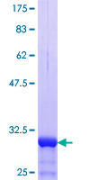 SLC25A24 / APC1 Protein - 12.5% SDS-PAGE Stained with Coomassie Blue.