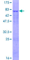 SLC25A25 Protein - 12.5% SDS-PAGE of human SLC25A25 stained with Coomassie Blue