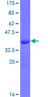 SLC25A25 Protein - 12.5% SDS-PAGE Stained with Coomassie Blue.