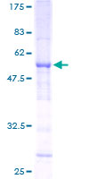 SLC25A27 / UCP4 Protein - 12.5% SDS-PAGE of human SLC25A27 stained with Coomassie Blue