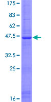 SLC25A28 Protein - 12.5% SDS-PAGE of human SLC25A28 stained with Coomassie Blue