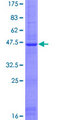 SLC25A28 Protein - 12.5% SDS-PAGE of human SLC25A28 stained with Coomassie Blue
