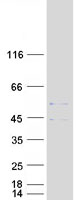 SLC25A3 Protein - Purified recombinant protein SLC25A3 was analyzed by SDS-PAGE gel and Coomassie Blue Staining