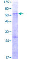 SLC25A33 Protein - 12.5% SDS-PAGE of human SLC25A33 stained with Coomassie Blue