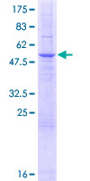 SLC25A35 Protein - 12.5% SDS-PAGE of human SLC25A35 stained with Coomassie Blue