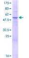 SLC25A35 Protein - 12.5% SDS-PAGE of human SLC25A35 stained with Coomassie Blue