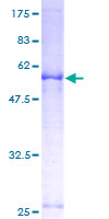 SLC25A36 Protein - 12.5% SDS-PAGE of human FLJ10618 stained with Coomassie Blue