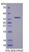 SLC25A37 / Mitoferrin Protein - Recombinant  Mitoferrin By SDS-PAGE