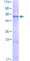 SLC25A38 Protein - 12.5% SDS-PAGE of human SLC25A38 stained with Coomassie Blue
