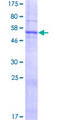 SLC25A38 Protein - 12.5% SDS-PAGE of human SLC25A38 stained with Coomassie Blue