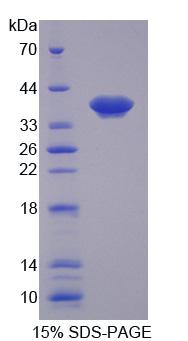 SLC25A39 Protein - Recombinant Solute Carrier Family 25, Member 39 (SLC25A39) by SDS-PAGE