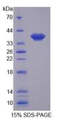 SLC25A39 Protein - Recombinant Solute Carrier Family 25, Member 39 (SLC25A39) by SDS-PAGE