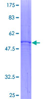 SLC25A4 / ANT Protein - 12.5% SDS-PAGE of human SLC25A4 stained with Coomassie Blue