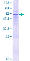 SLC25A40 Protein - 12.5% SDS-PAGE of human SLC25A40 stained with Coomassie Blue