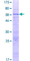 SLC25A42 Protein - 12.5% SDS-PAGE of human SLC25A42 stained with Coomassie Blue