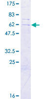 SLC25A43 Protein - 12.5% SDS-PAGE of human SLC25A43 stained with Coomassie Blue