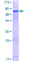 SLC25A46 Protein - 12.5% SDS-PAGE of human SLC25A46 stained with Coomassie Blue