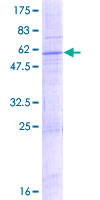 SLC25A47 / C14orf68 Protein - 12.5% SDS-PAGE of human C14orf68 stained with Coomassie Blue