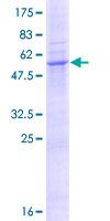 SLC25A51 / MCART1 Protein - 12.5% SDS-PAGE of human MCART1 stained with Coomassie Blue