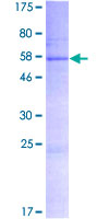 SLC25A52 Protein - 12.5% SDS-PAGE of human MCART2 stained with Coomassie Blue