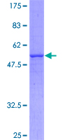 SLC25A6 / ANT3 Protein - 12.5% SDS-PAGE of human SLC25A6 stained with Coomassie Blue