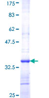 SLC25A6 / ANT3 Protein - 12.5% SDS-PAGE Stained with Coomassie Blue.