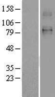 SLC26A2 Protein - Western validation with an anti-DDK antibody * L: Control HEK293 lysate R: Over-expression lysate