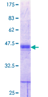 SLC26A2 Protein - 12.5% SDS-PAGE Stained with Coomassie Blue.