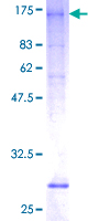 SLC26A3 / DRA Protein - 12.5% SDS-PAGE of human SLC26A3 stained with Coomassie Blue