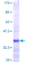 SLC26A3 / DRA Protein - 12.5% SDS-PAGE Stained with Coomassie Blue.