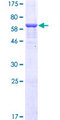 SLC26A4 / Pendrin Protein - 12.5% SDS-PAGE Stained with Coomassie Blue.
