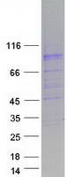 SLC26A4 / Pendrin Protein - Purified recombinant protein SLC26A4 was analyzed by SDS-PAGE gel and Coomassie Blue Staining