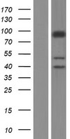 SLC26A5 Protein - Western validation with an anti-DDK antibody * L: Control HEK293 lysate R: Over-expression lysate